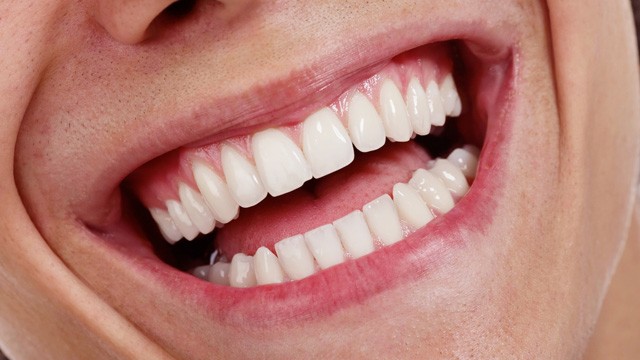 smile